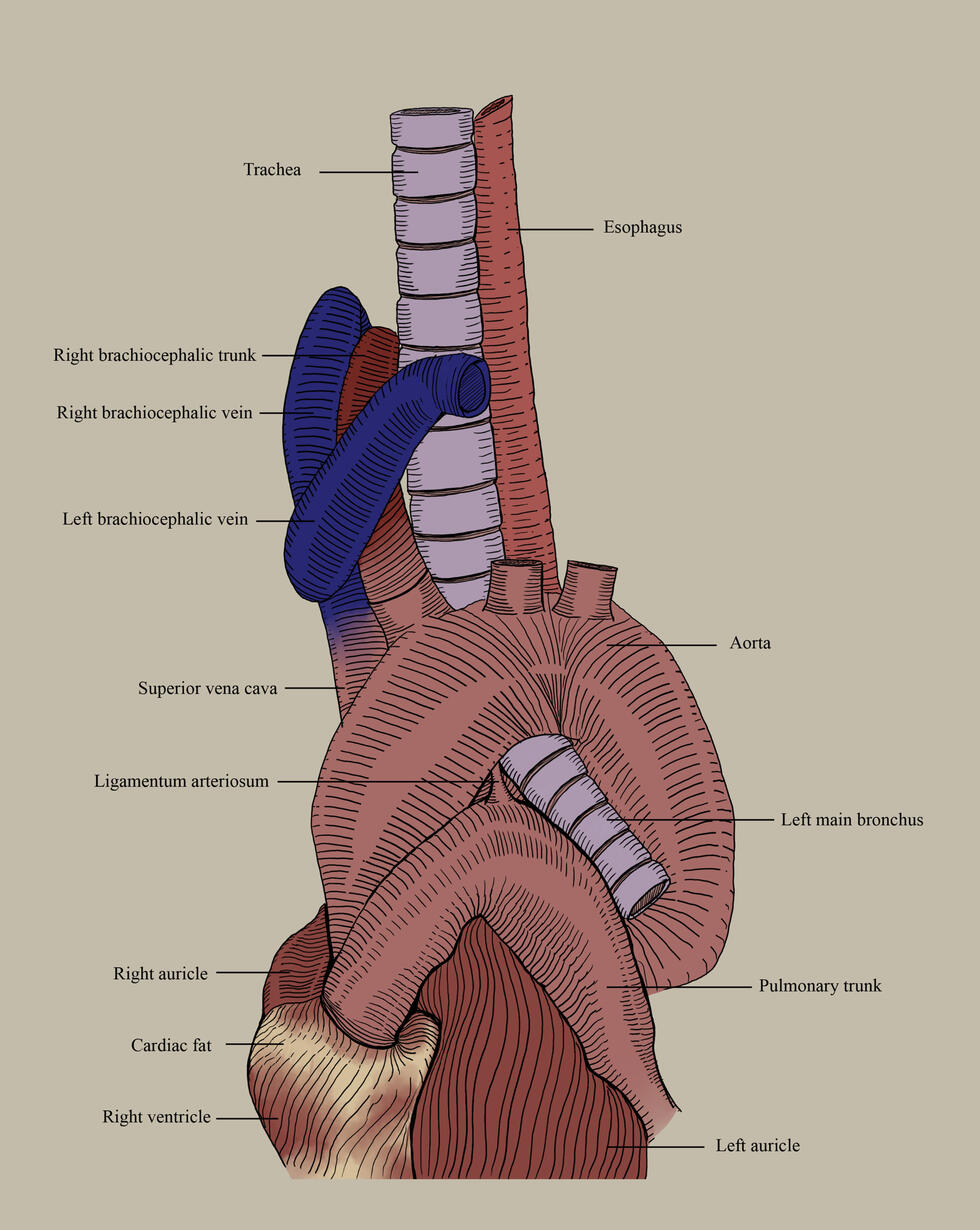 Left lateral view of Aortic arch branches displaying relationship with Trachea and Esophagus Left lateral view of Aortic arch branches displaying relationship with Trachea and Esophagus